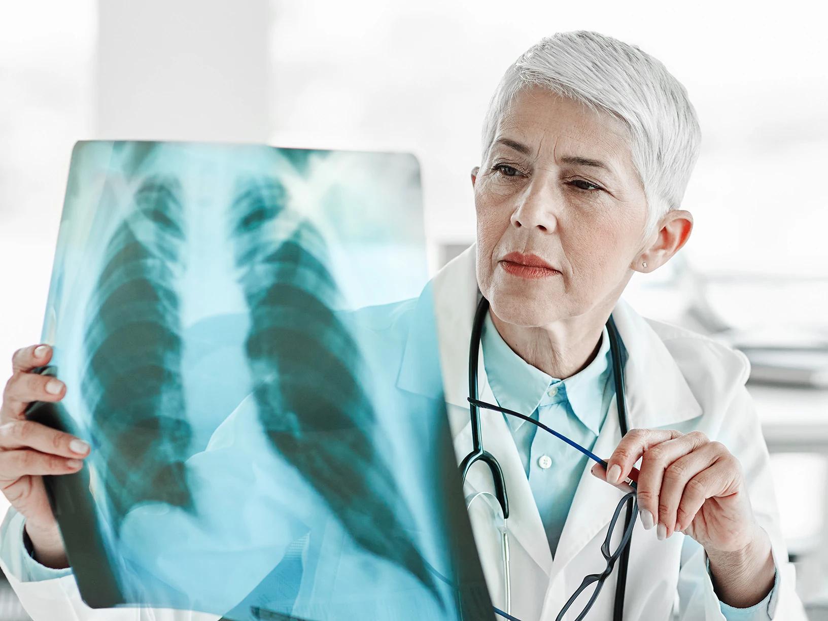 Intern mediciner med lungerøntgen